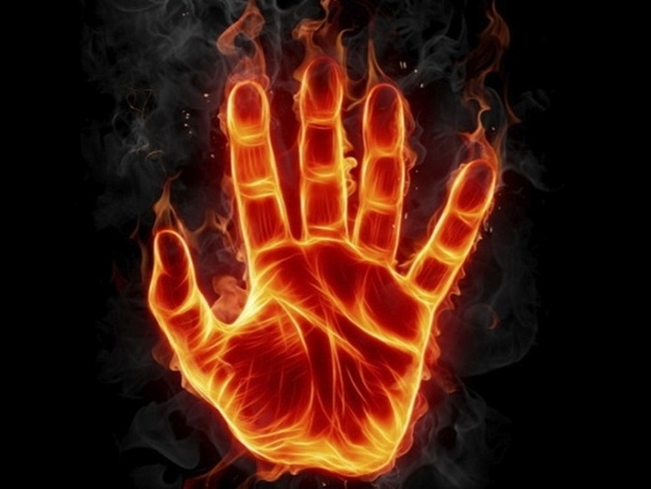 /blog/images/Burning-hand2